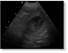 Ultraschallbild vom 26. März 2010 - Bild 3